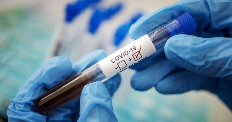 В Азербайджане 142 человека заразились коронавирусом Статистика с 11 по 17 сентября/ ФОТО